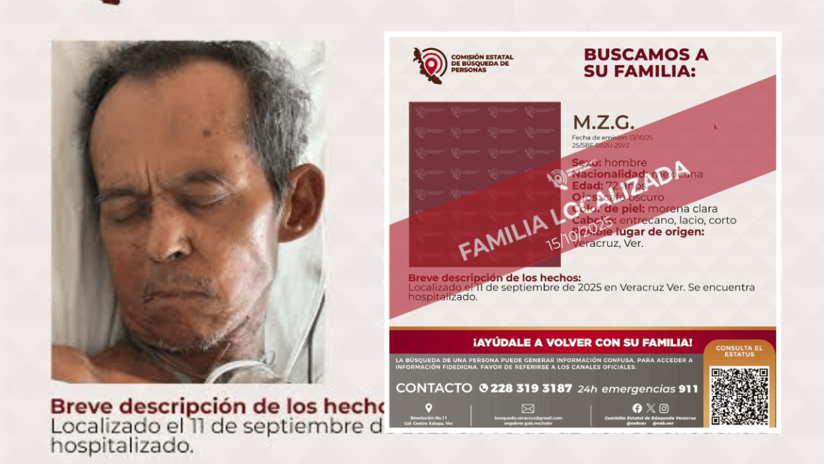 Hombre fallece en hospital tras ataque de perro en Boca del Río